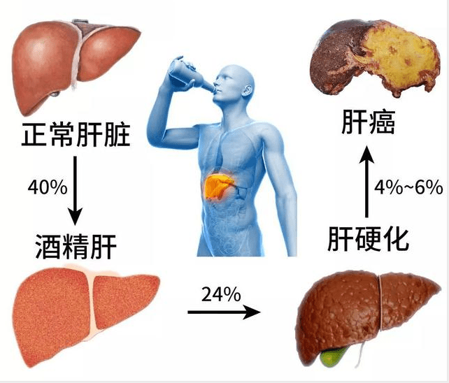 醉酒后喝了蜂蜜水能不能喝茶_酒后喝茶舌头发黑是怎么回事_酒后喝茶高血压